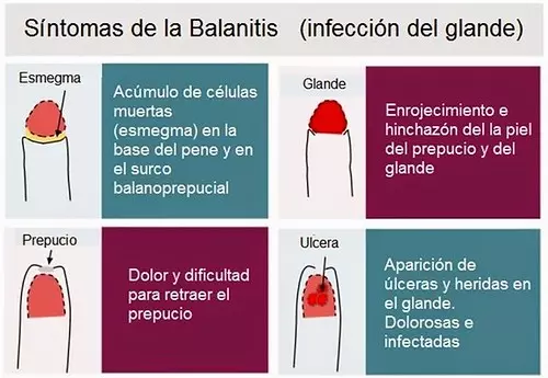 Balanopostitis