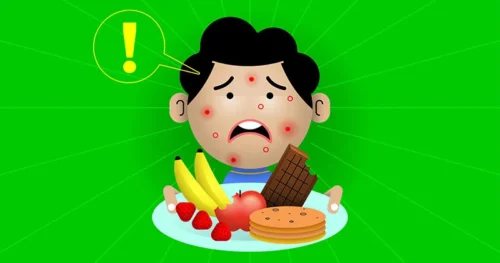 Alergias Alimentarias