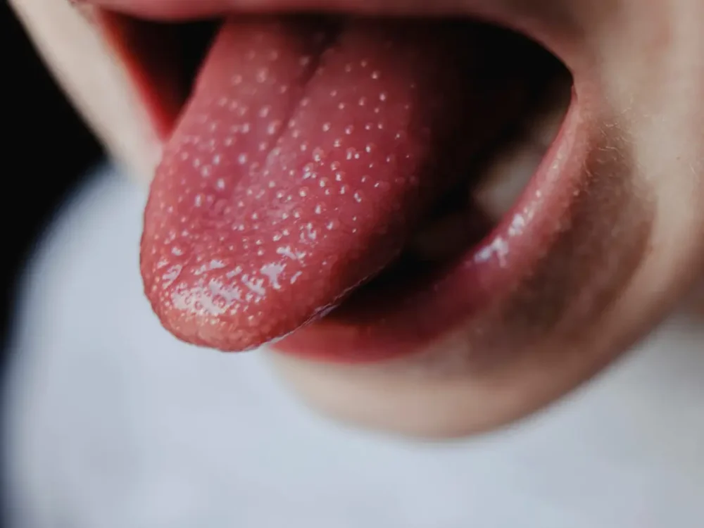 Granito en la Lengua