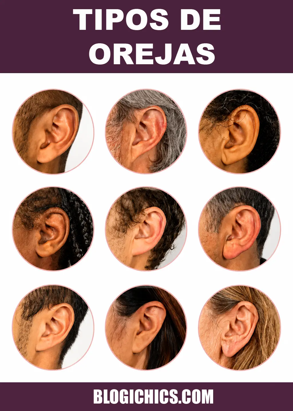 Tipos de Orejas