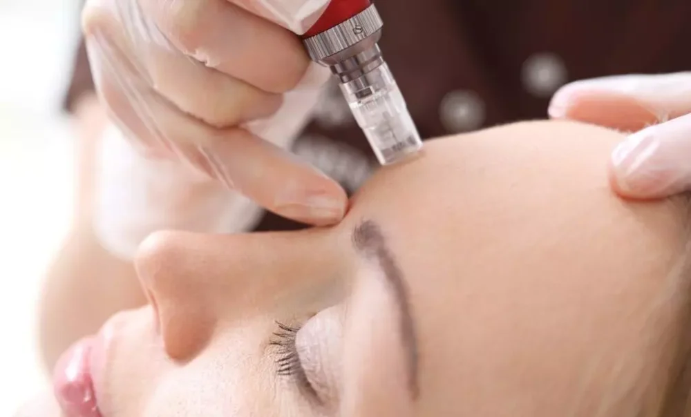 Microneedling Dermapen
