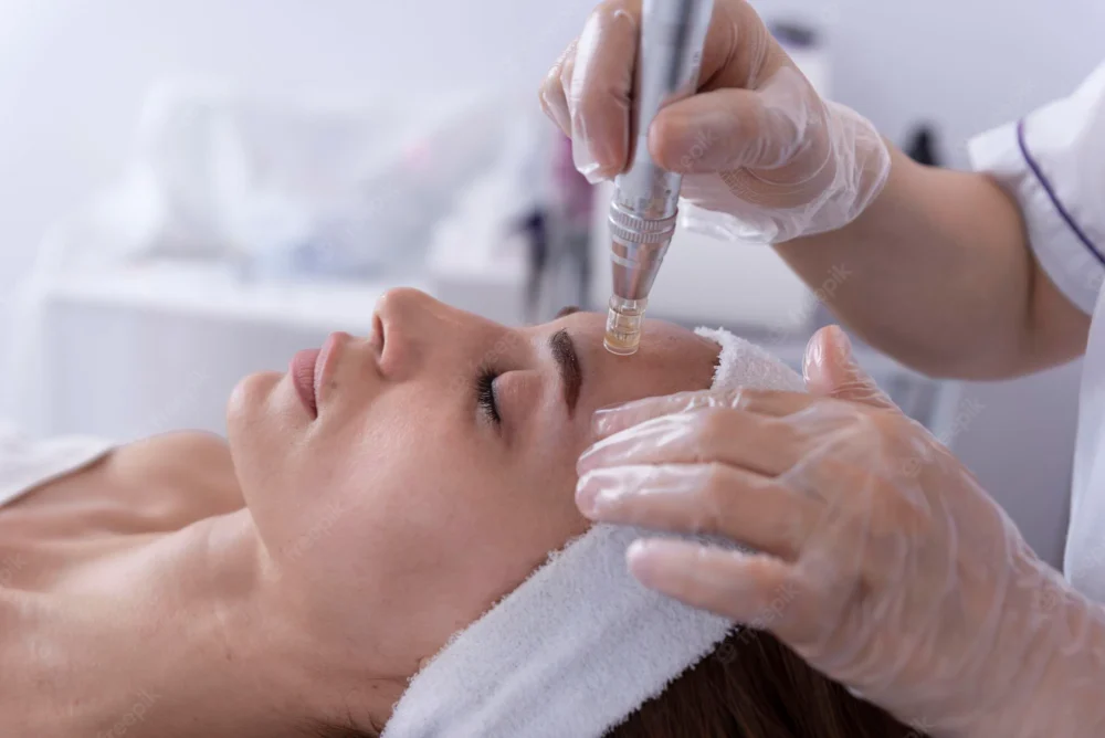 Dermapen Facial